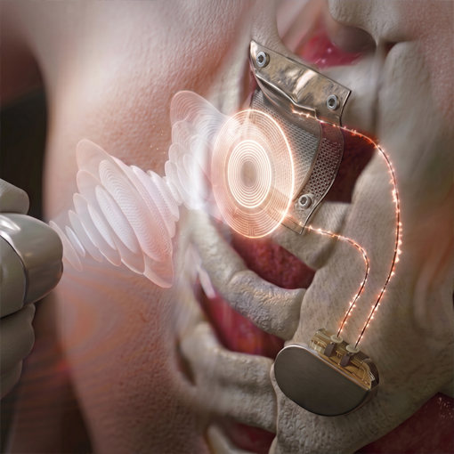 New generation energy transfer